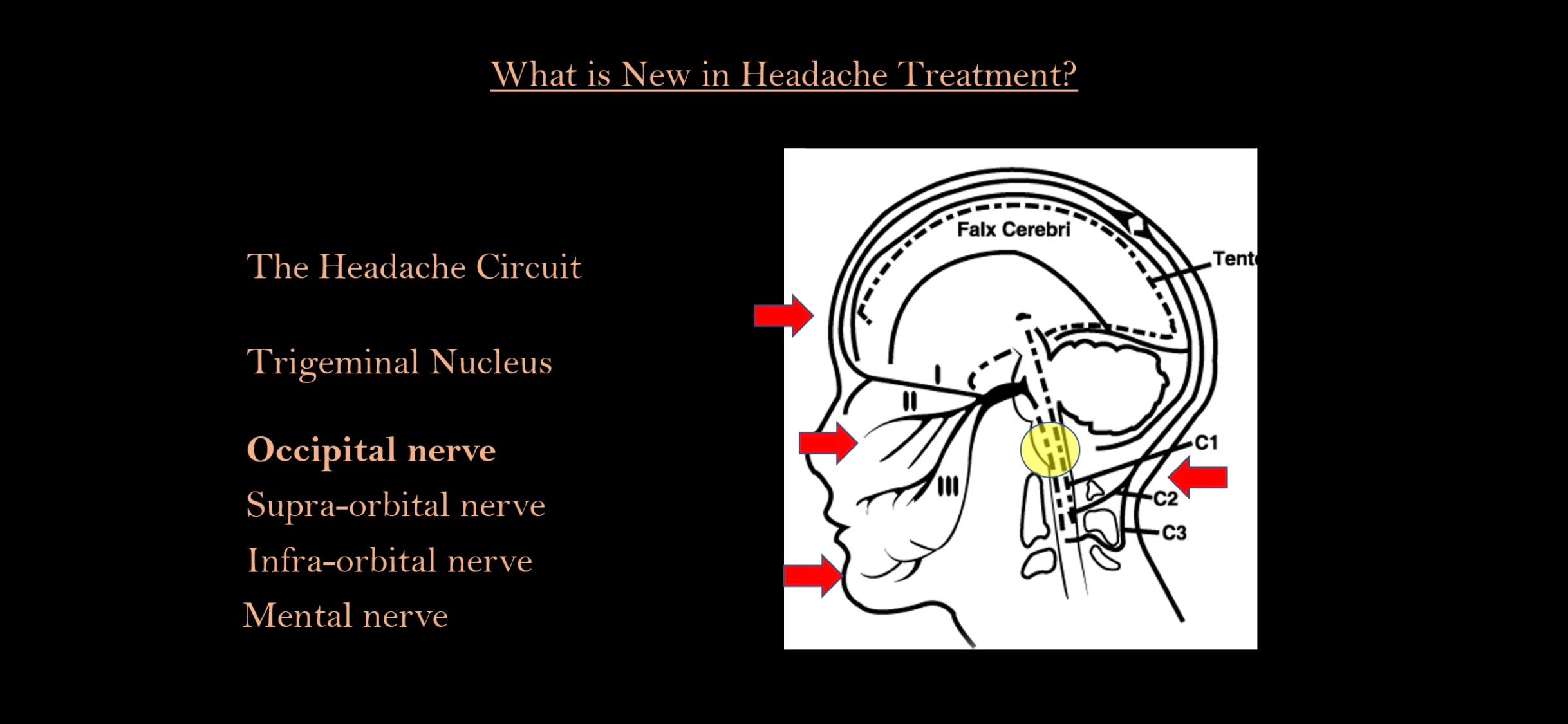 Migraine and cluster headaches have a new and exciting treatment! by