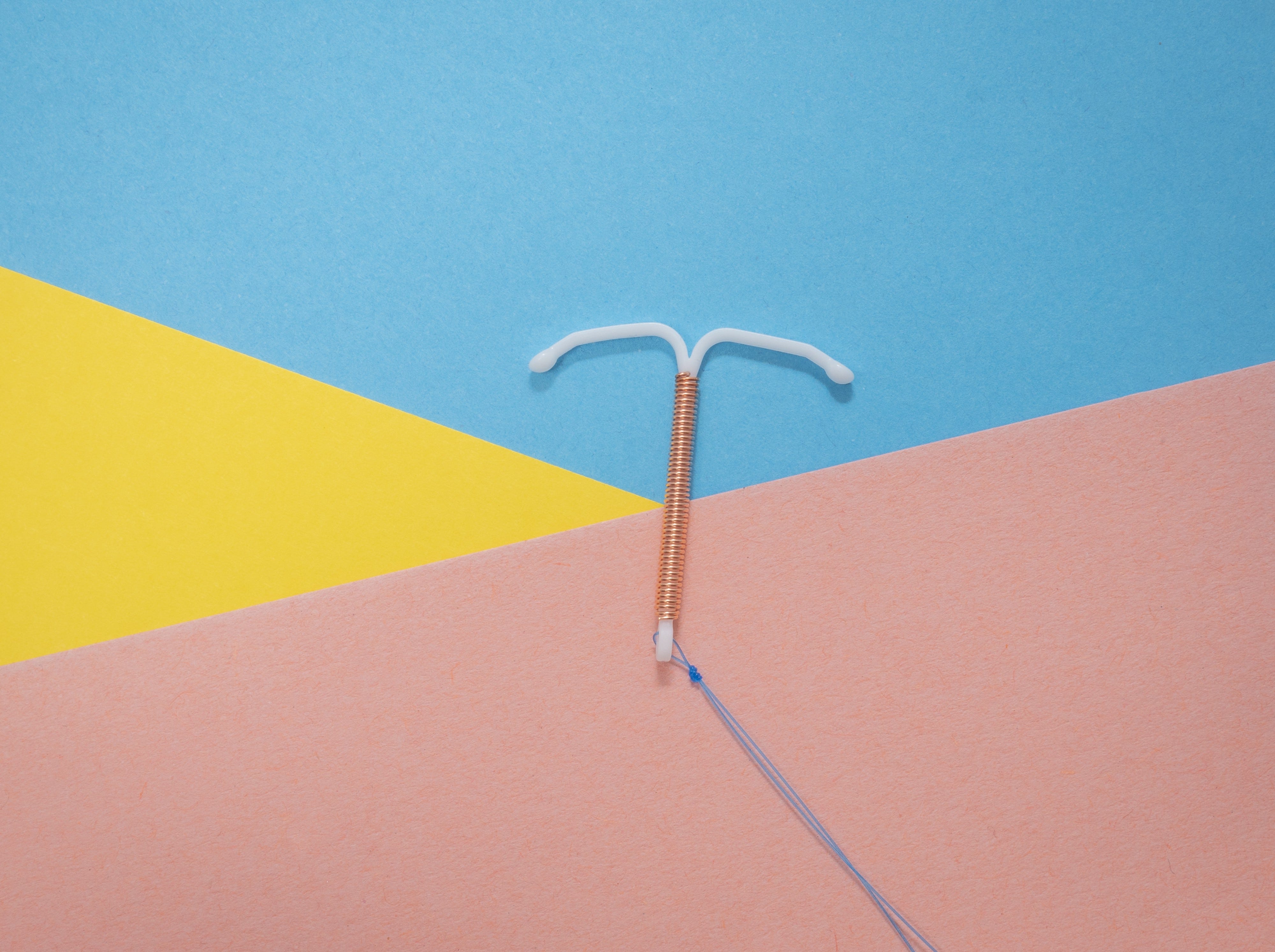Why did I have my copper IUD removed ? by Sandrine Petrenko