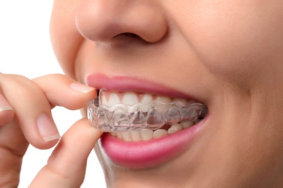 Does Invisalign Cause Headaches?. Invisalign clear aligners are an… by Dr. Ryan M. Clancy Medium