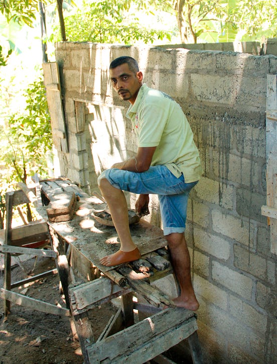 A Locally Manufactured Foot and a Ray of Hope for Amputees in Sri Lanka