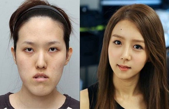 The Destructive Effects Of South Korea's Beauty Standards | By Karin Cho | Invisible Illness | Medium