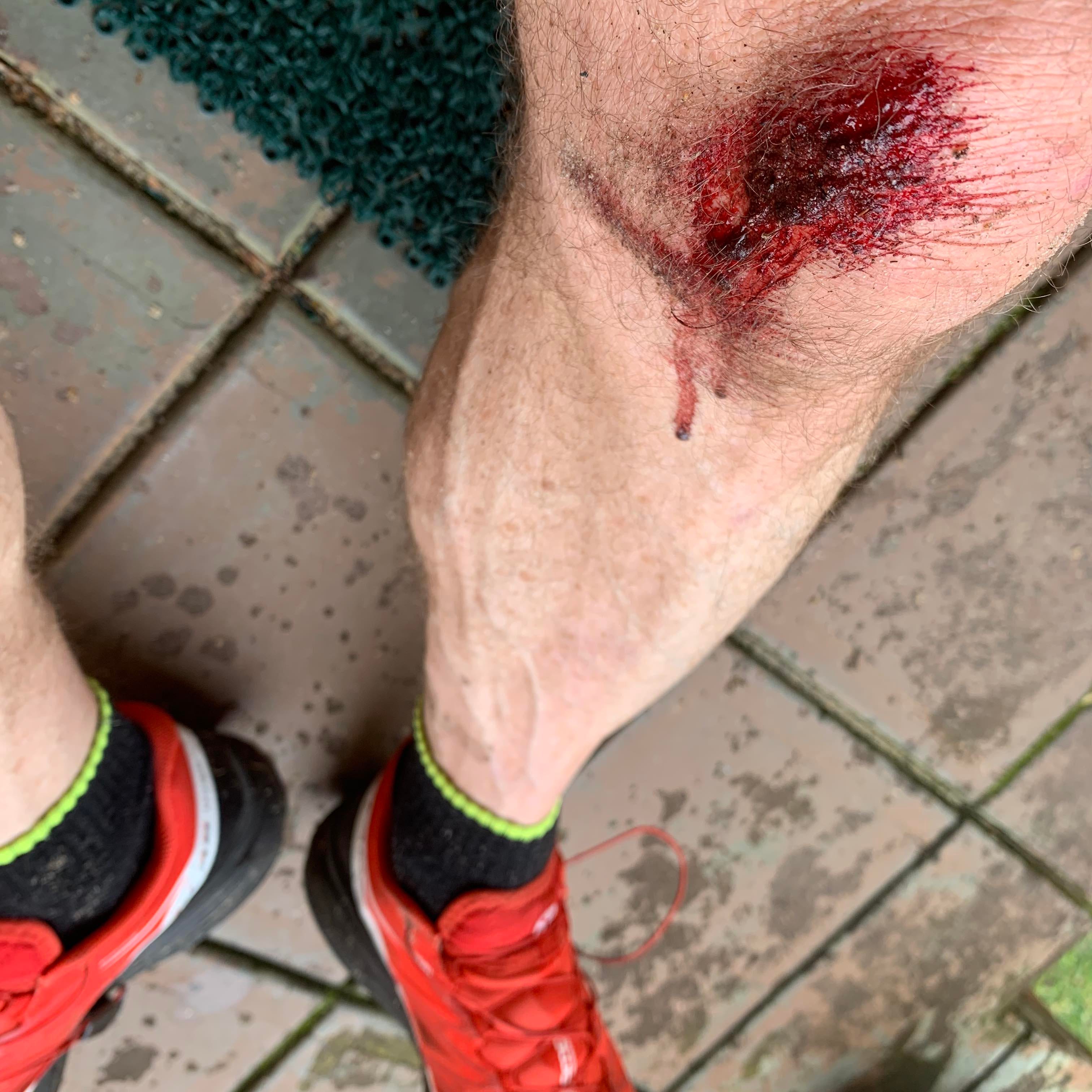 Can You Run 3km Every Day For 3 weeks? — Here’s What Happened by