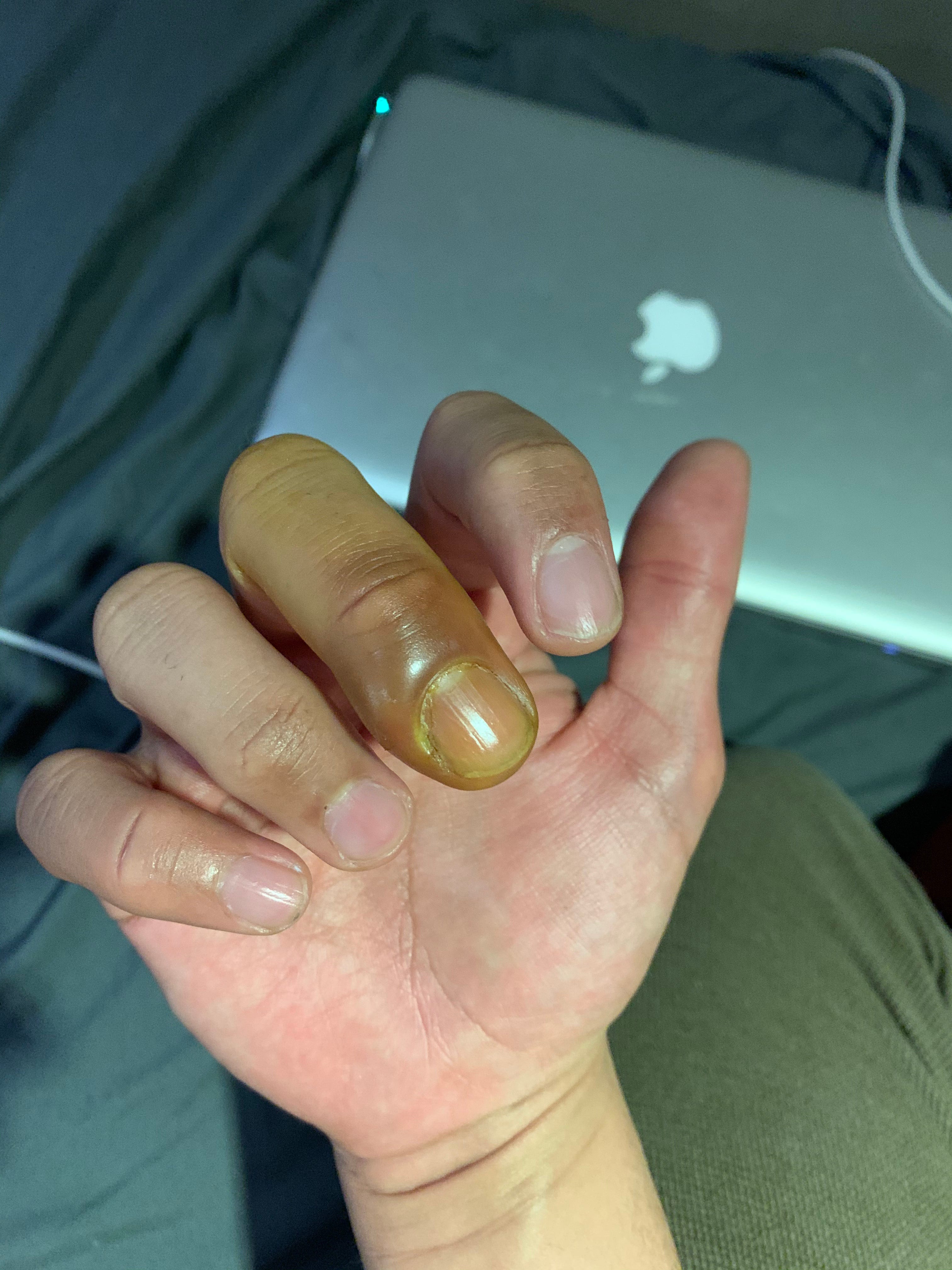 I Was Forced Into a Chinese Hospital Health Tonic Medium