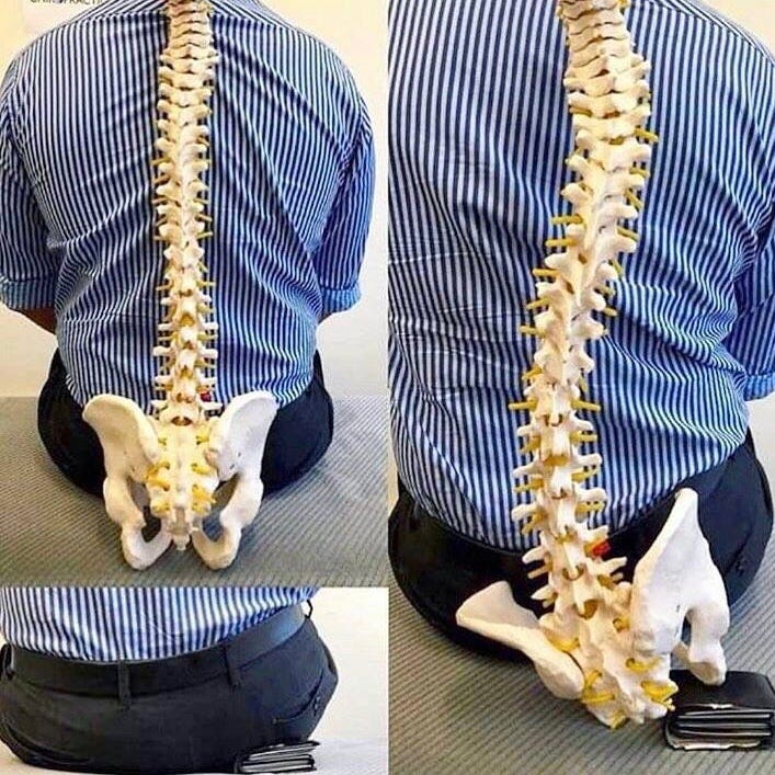 Stop Sitting On Your Wallet! It’s Slowly Destroying Your Spine!