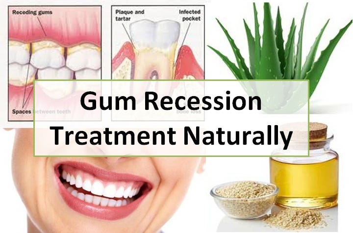 Gum Recession Treatment Naturally At Home by Ashley W. Johnson Medium