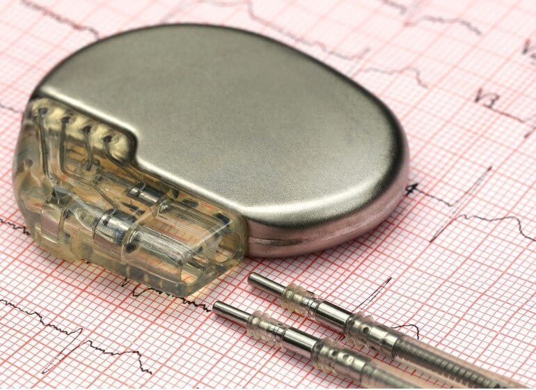 FDA Alert Indicates Some Medtronic Pacemaker Batteries Can Fail Without