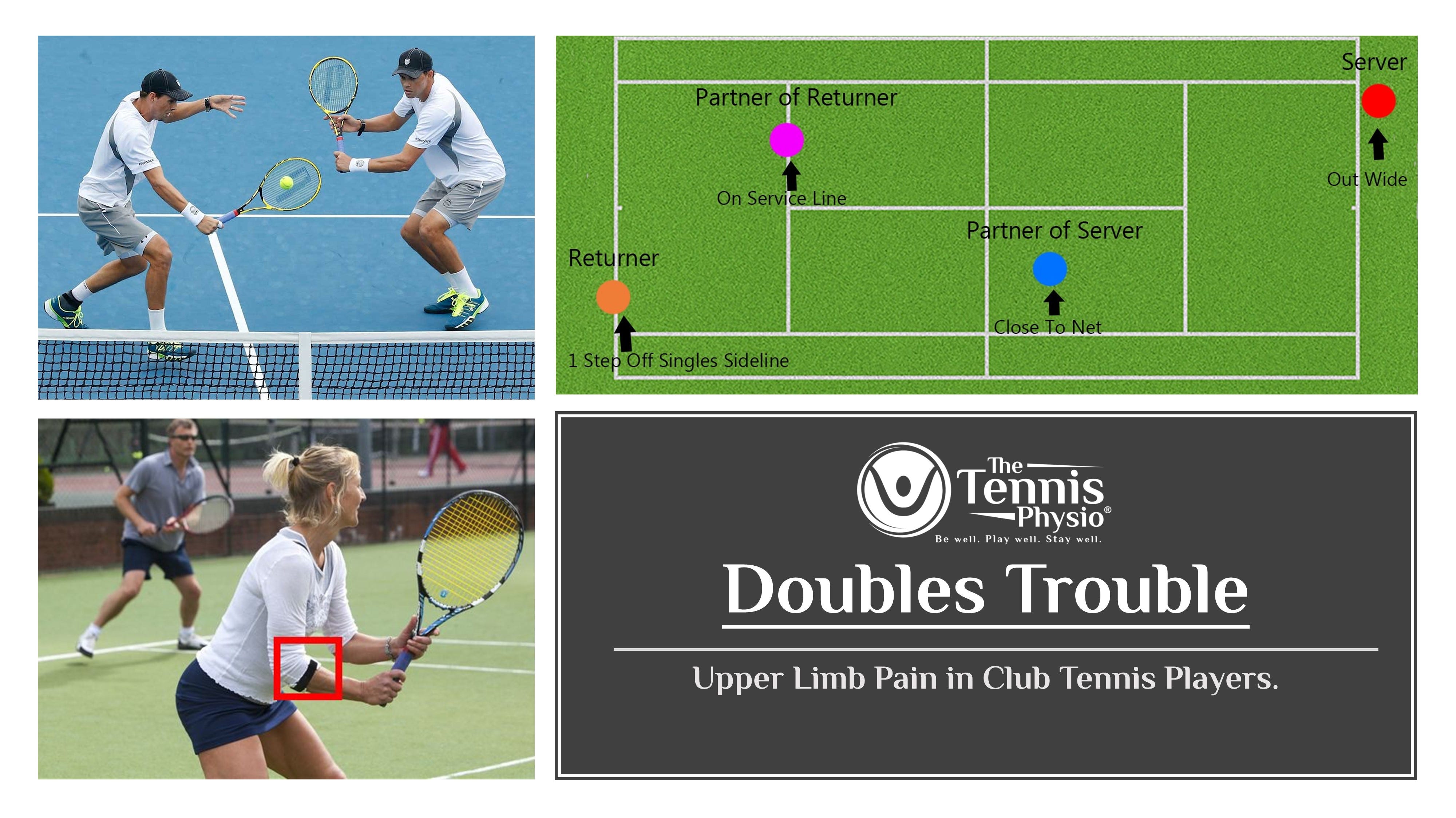 Doubles Trouble — Upper Limb Pain in Club Tennis Players. by The
