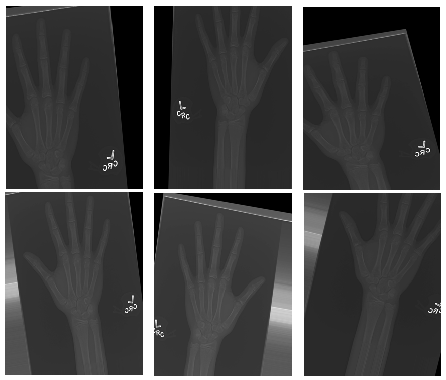 Bone age prediction through xray images by Inside.TechLabs
