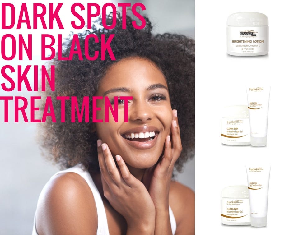 Dark Spots on Black Skin Treatment by Black Skin Medium