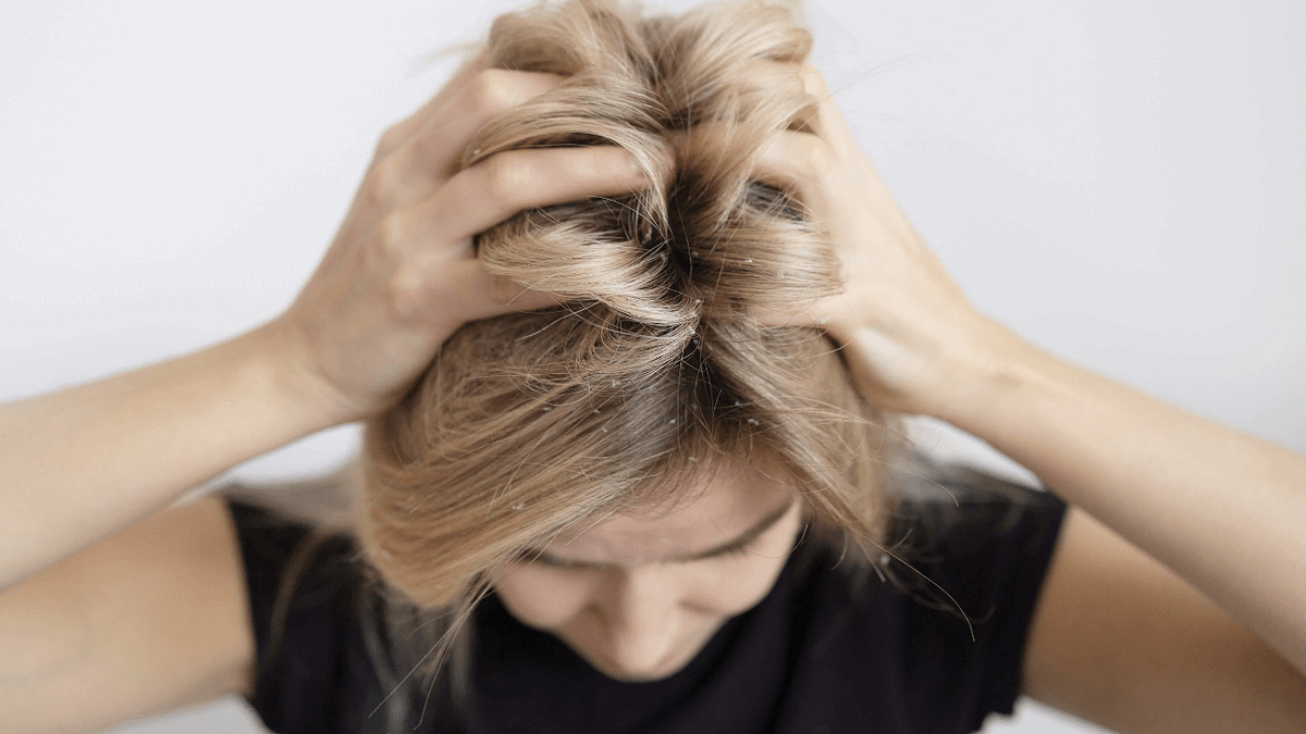 Why Does My Scalp Itch at Night — Symptoms, Causes, Remedy by Clara Wilson Medium