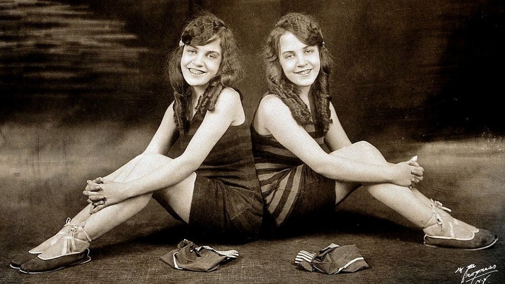 Violet And Daisy Conjoined Twins(011)