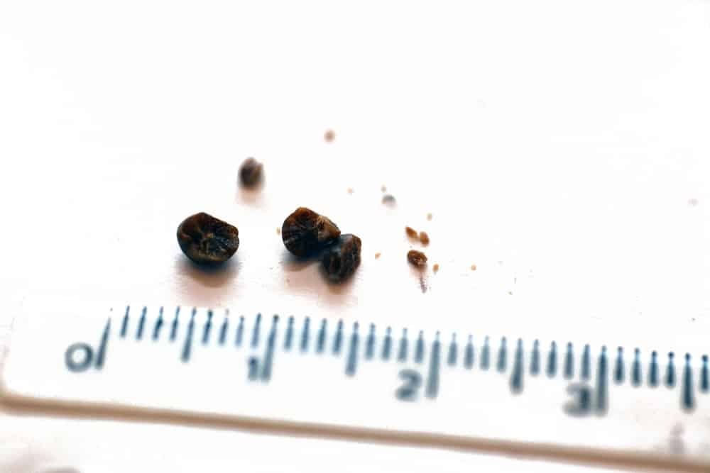 How Do You Treat The Different Sizes Of Kidney Stones Differently? by Calcium Oxalate Labs