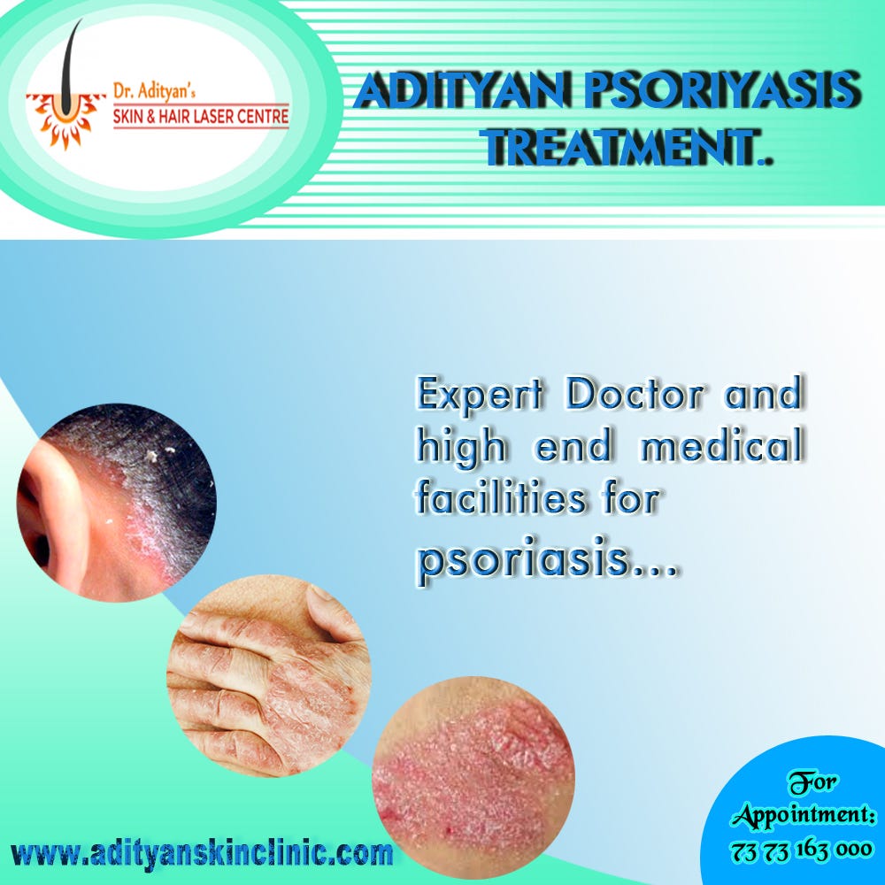 How can psoriasis flareups be prevented? by jontmardon Medium