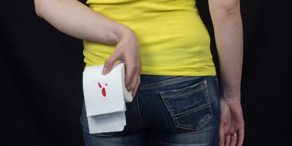 How Long Does It Take for Anal Fissures to Heal? by Dr. Chintamani