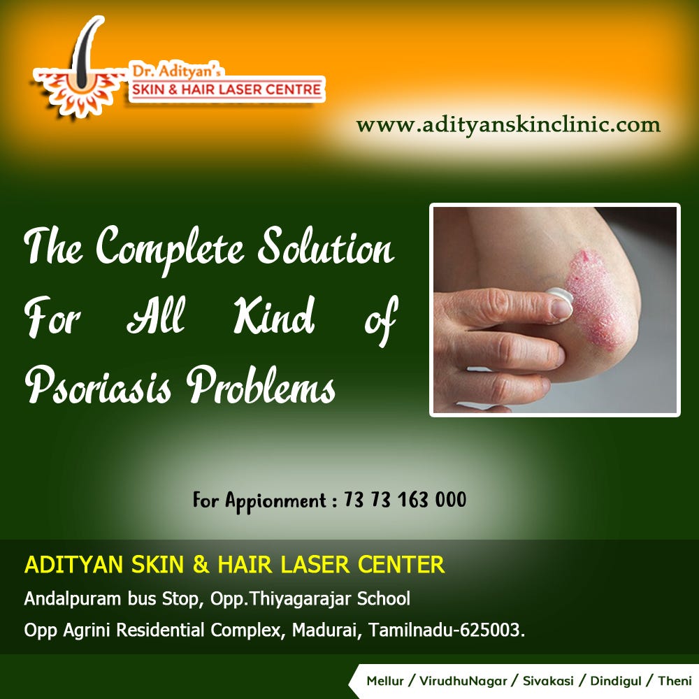 Scalp Psoriasis — Psoriasis Treatment In Dindigul — www