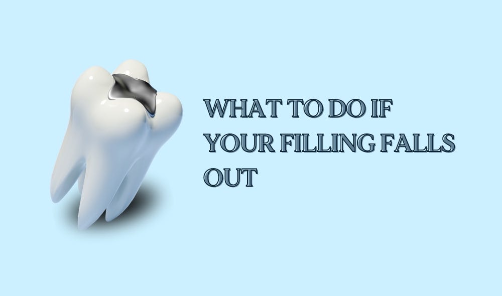 What to Do If Your Filling Falls Out by Modern Dentistry of Jupiter