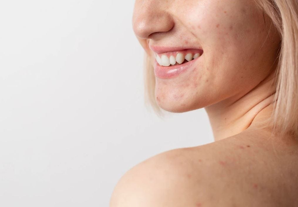 Where to Measure Neck for Body Fat A Simple Guide by SlimBEE Sep