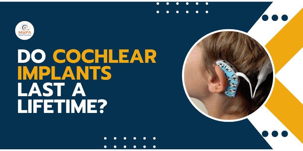 Do cochlear implants last a lifetime? by Mufameditourism Jul, 2023
