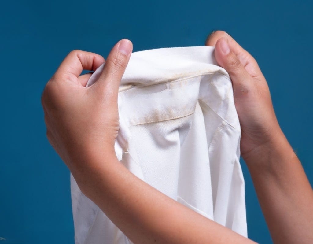 Yellowing of White Clothes Causes by Lulu Laundry Service Medium