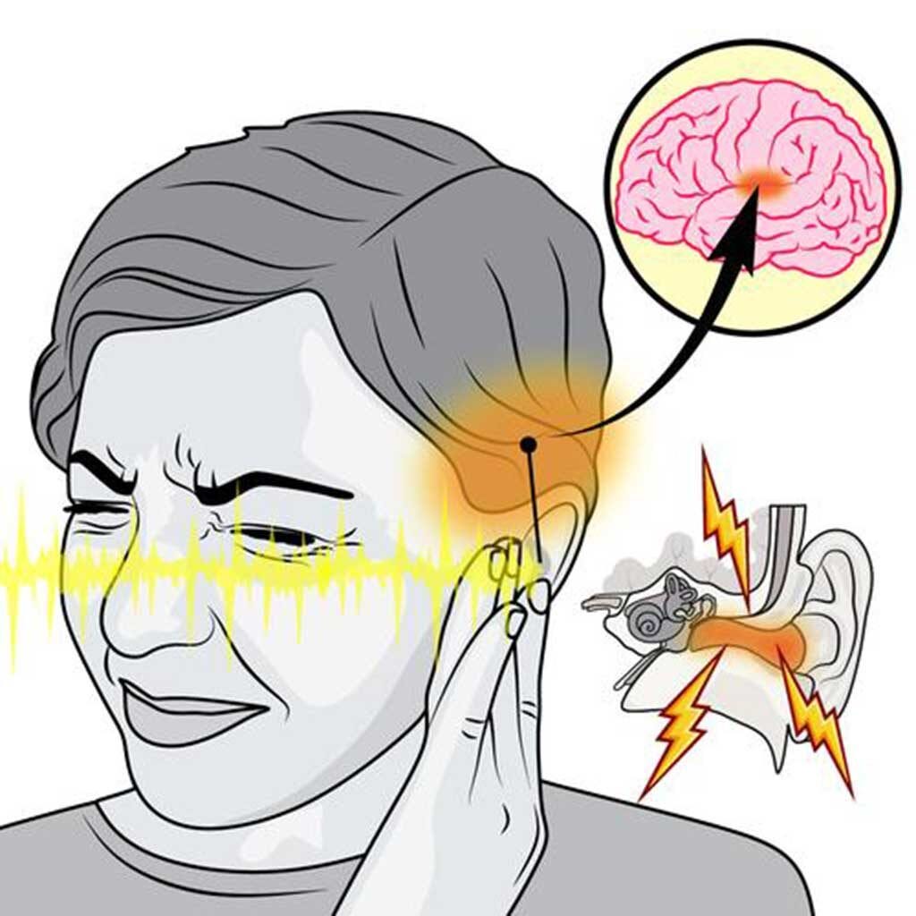 Tinnitus and Brain Damage Understanding the Link by tinnitus