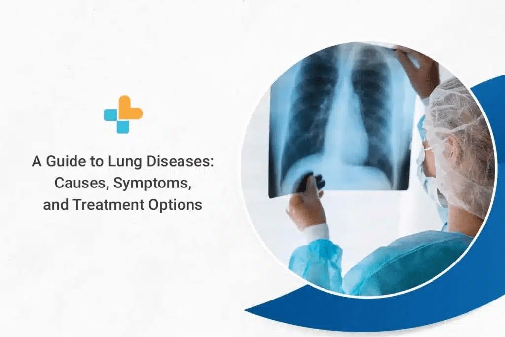 A Guide to Lung Diseases Causes, Symptoms, and Treatment Options by