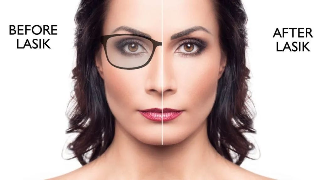 Lasik Surgery — What is the procedure before, during, and after the
