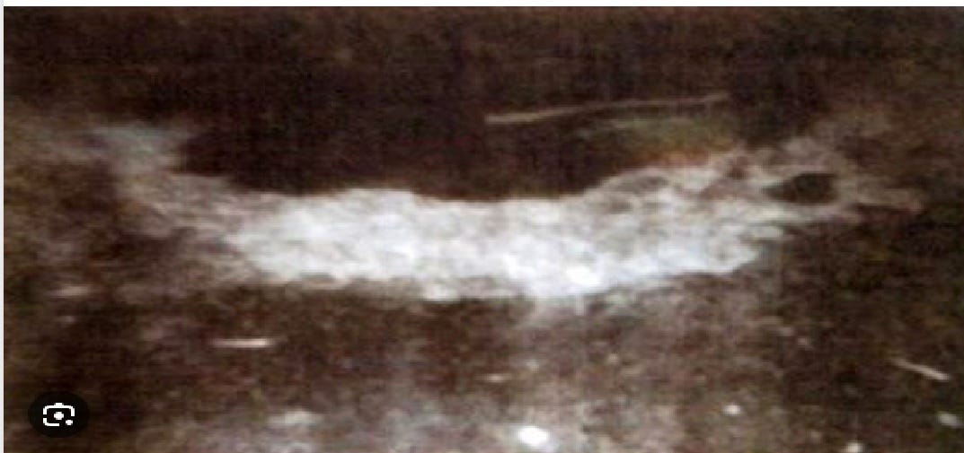 What Are the Physical Traces Left Behind by UFOs? Examining the Delphos