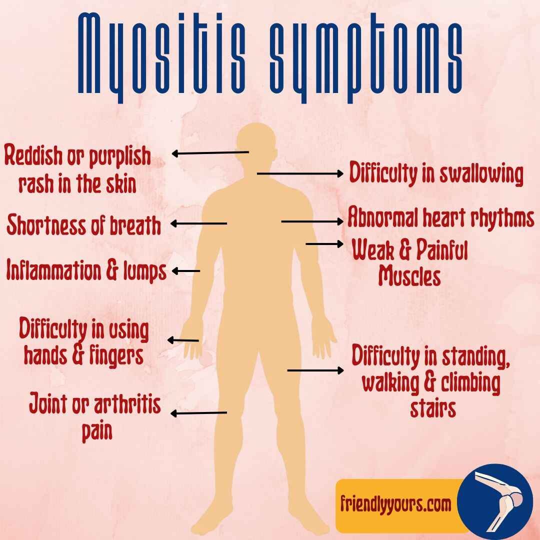 Is there any natural treatment for myositis? Know its causes, symptoms