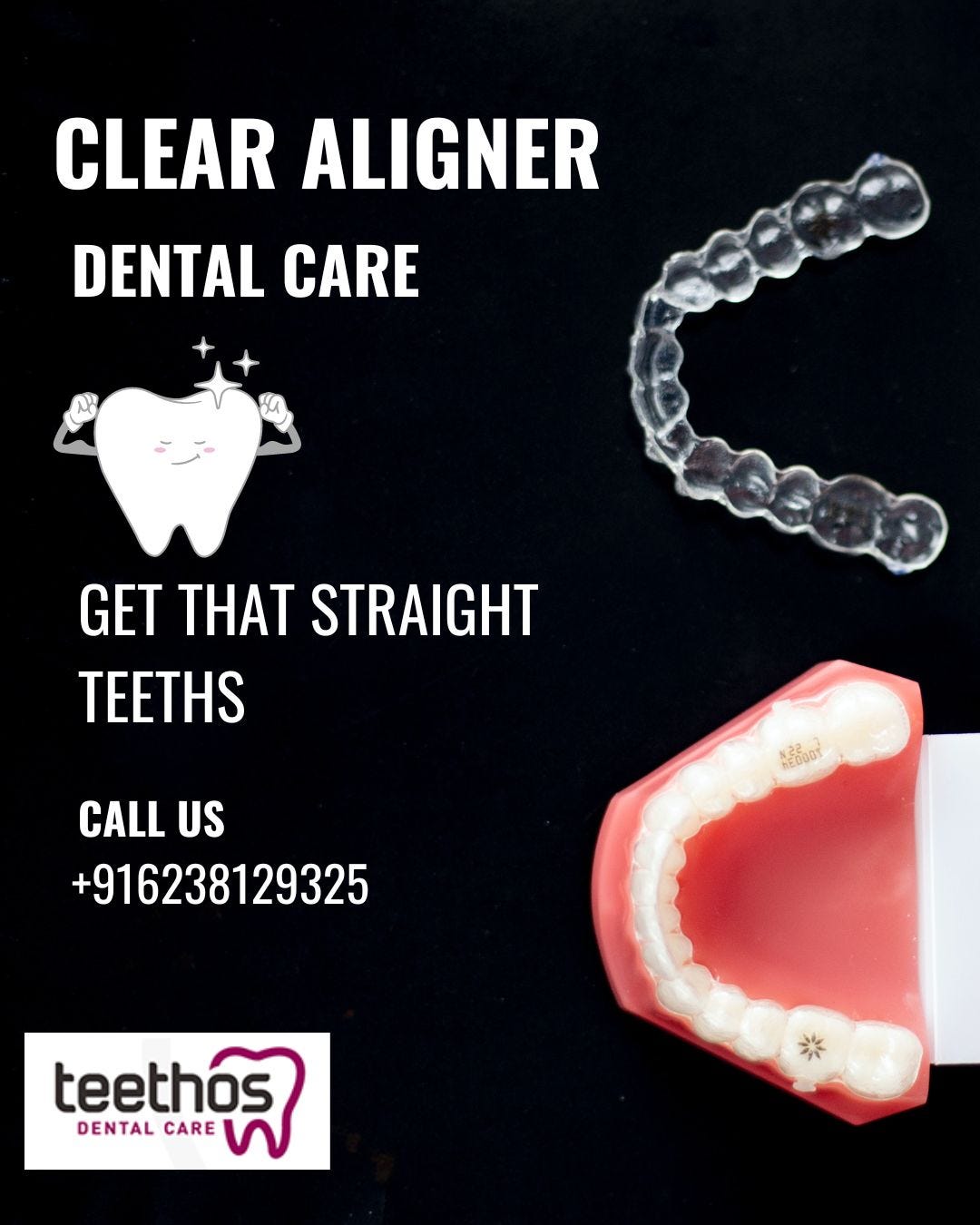 Are clear aligners in Kerala safe and worth using? by Teethos Dental