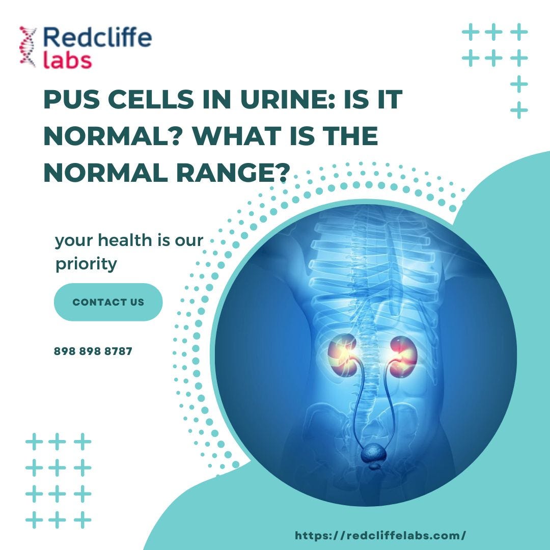 Pus cells in urine Is it normal? What is the normal range