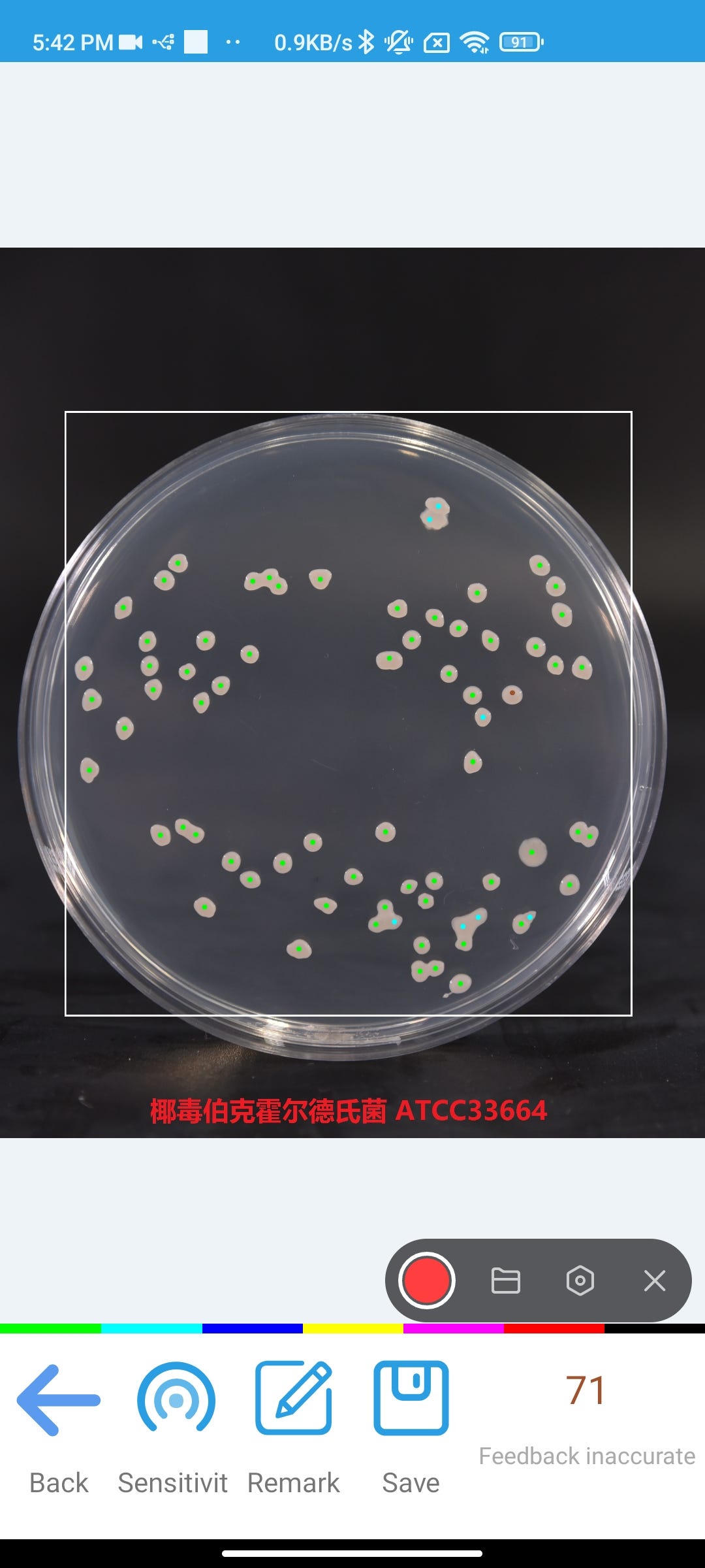 Automated Counting colonies on agar plates CountThings By Camera Medium