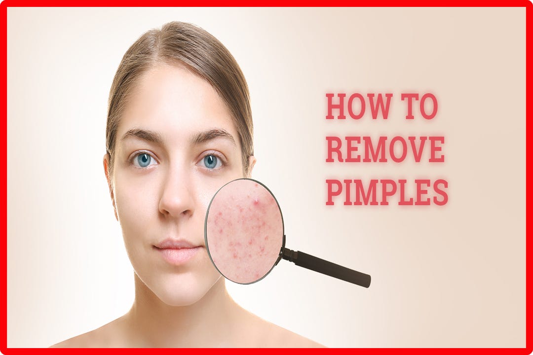 How To Remove Pimples On Face Digital Marketer Medium