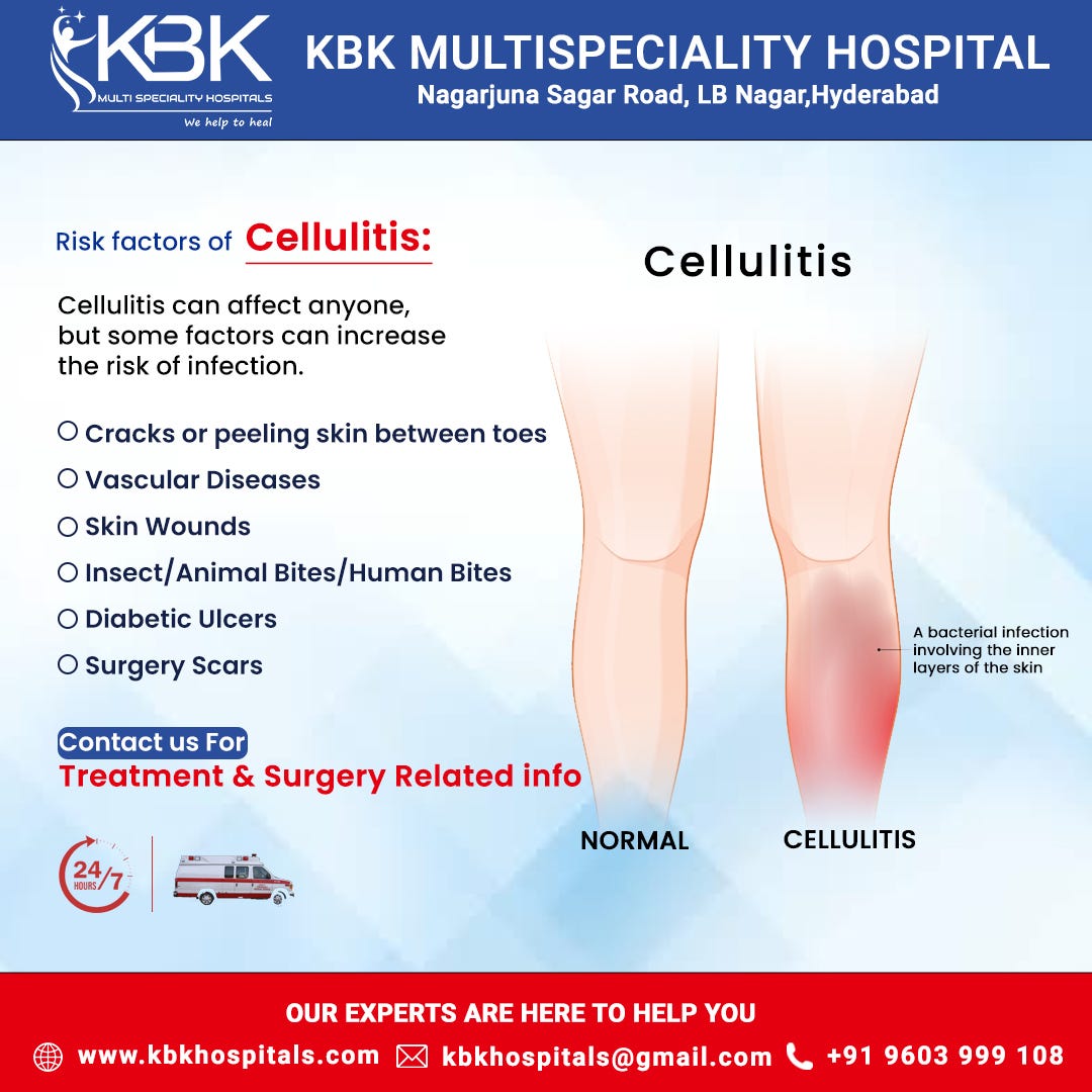 𝑹𝒊𝒔𝒌 𝑭𝒂𝒄𝒕𝒐𝒓𝒔 𝒐𝒇 𝑪𝒆𝒍𝒍𝒖𝒍𝒊𝒕𝒊𝒔 KBK Hospitals Medium