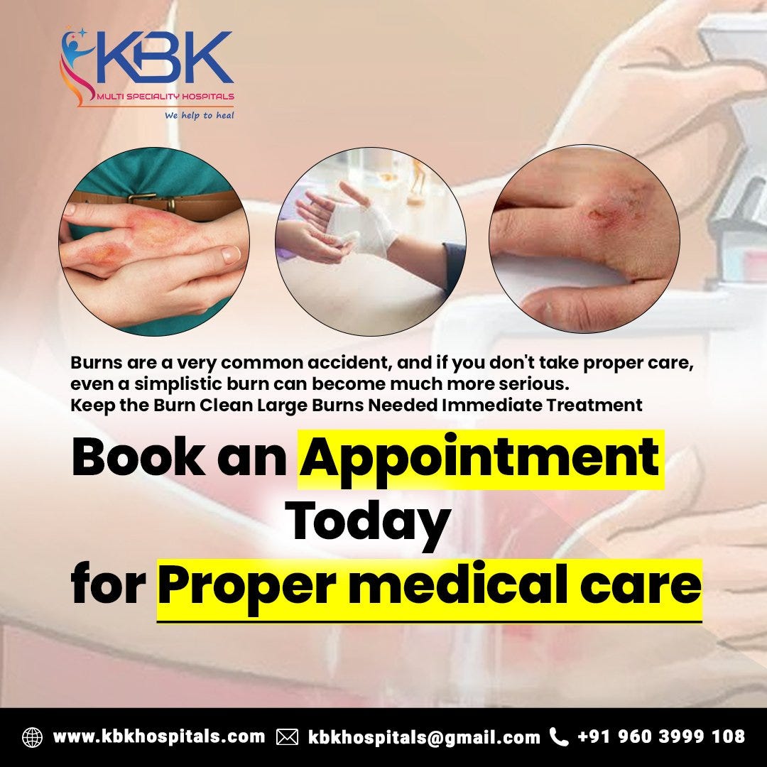 Burn Treatment in Hospital Hyderabad KBK Hospitals Medium