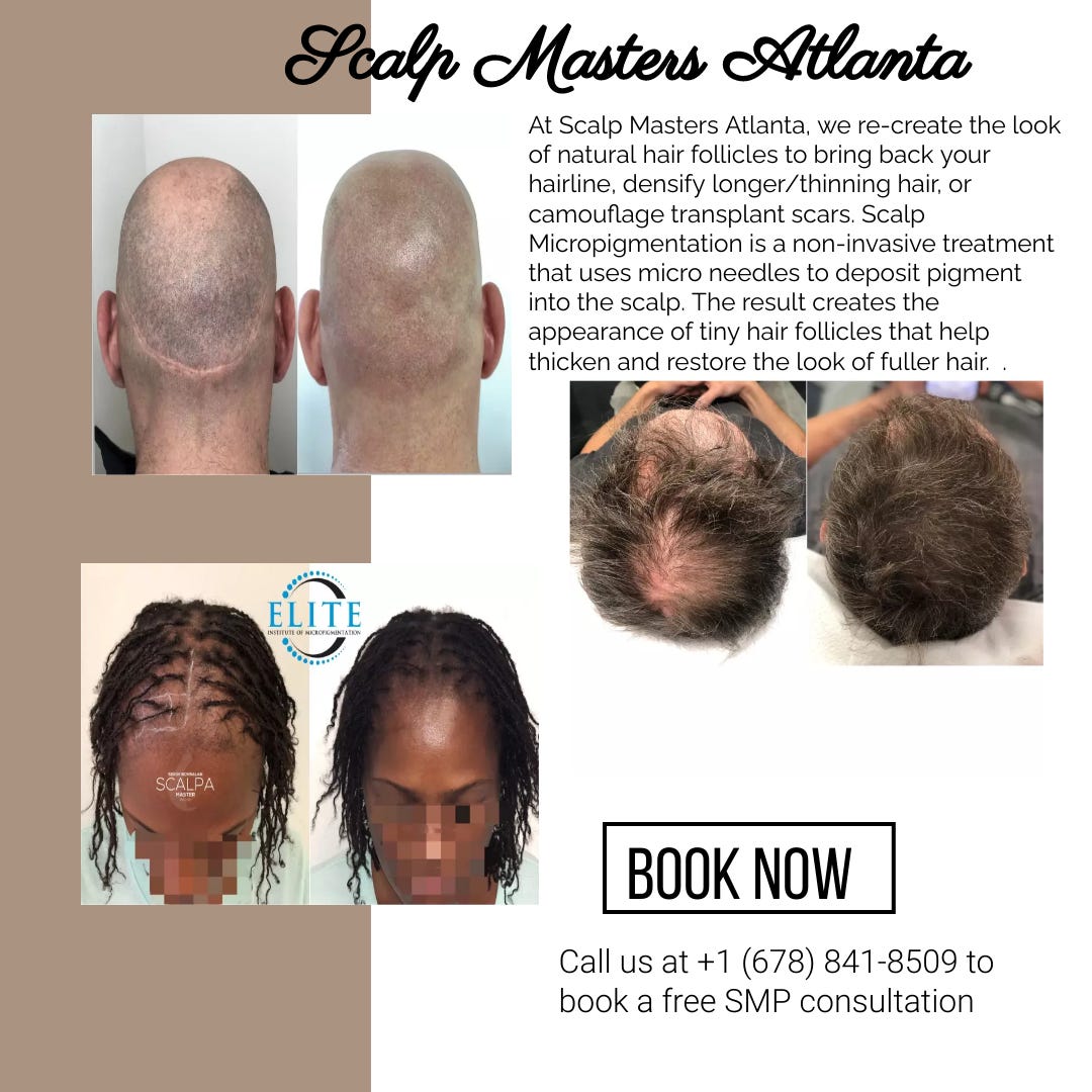 How Scalp Micropigmentation Can Help with Thinning Hair — Scalp Masters