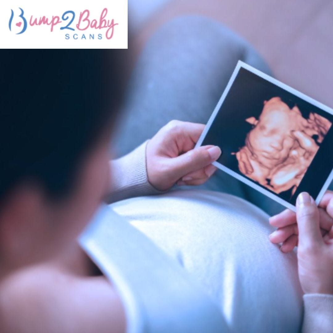 Thinking About a Private 3D Scan? Here’s How to Prepare by