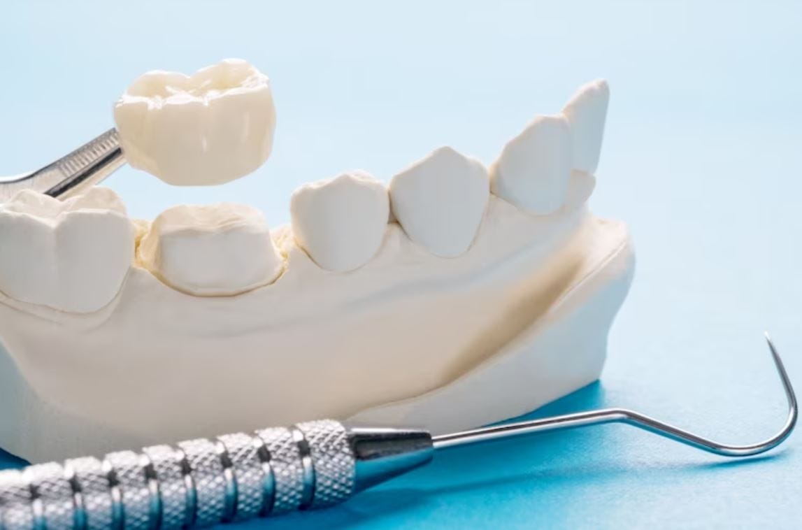 Why do temporary dental crowns hurt at times? by Amarnathan Medium