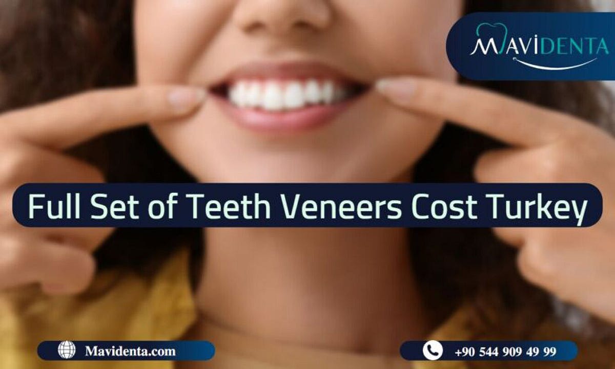 Full set of teeth veneers cost turkey by Mavidenta Clinic Medium