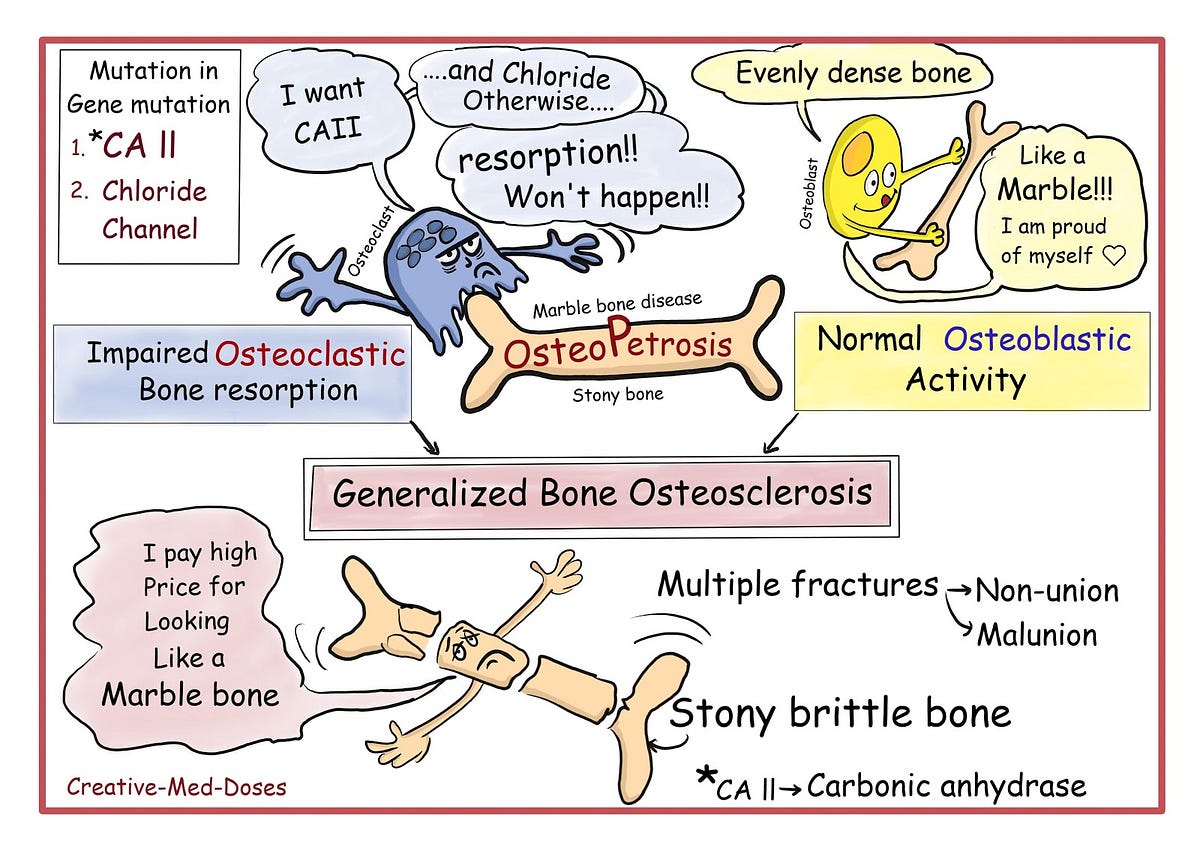 Osteopetrosis — Know It All!. All you need to know about Marble Bone