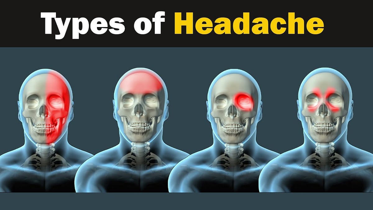 Headaches the Four Most Common Types , Cause , Managing by Dr Ali Bugti Mar, 2024 Medium