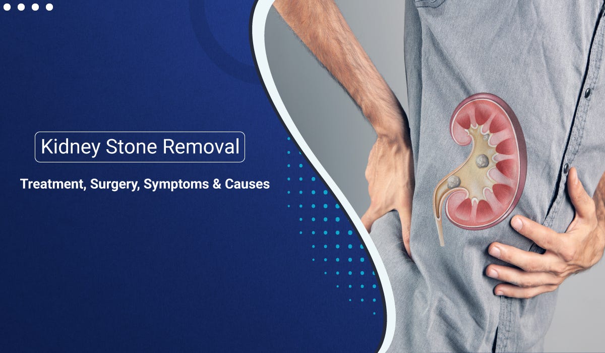 Kidney Stone Removal Treatment, Surgery, Symptoms & Causes by