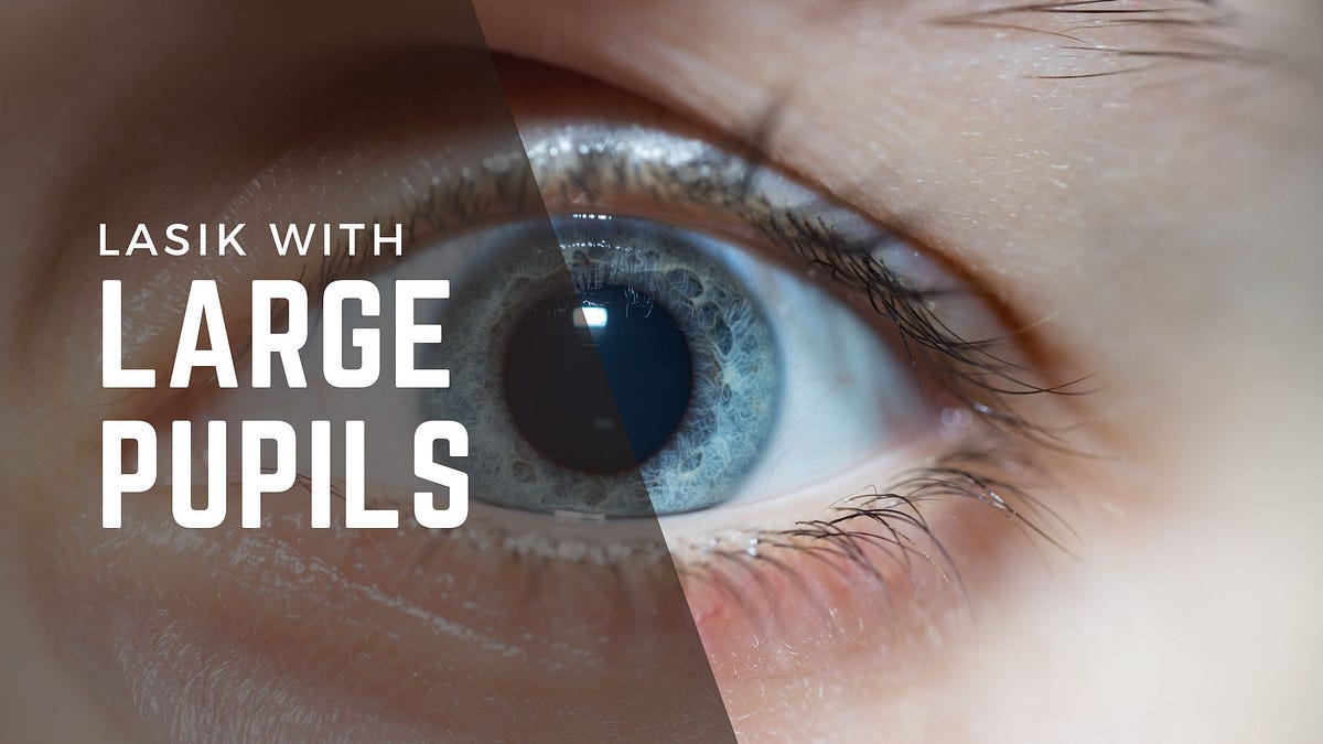 LASIK with Large Pupils. to our comprehensive guide on… by