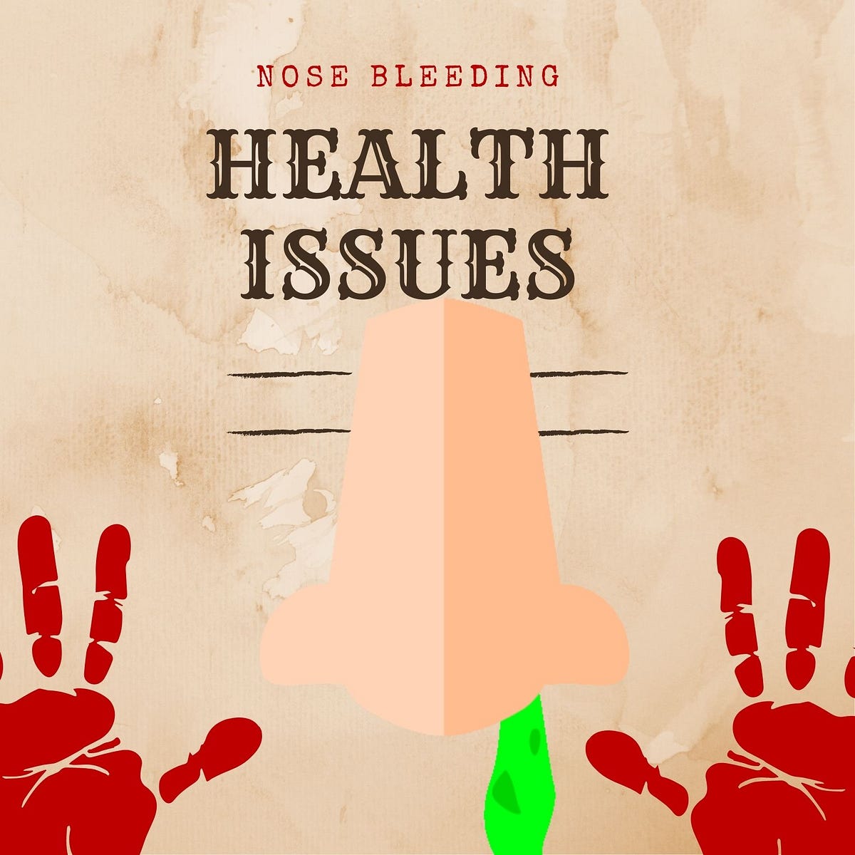 BLEEDING FROM THE NOSE, EITHER SPONTANEOUS OR INDUCED BY NOSE PICKING