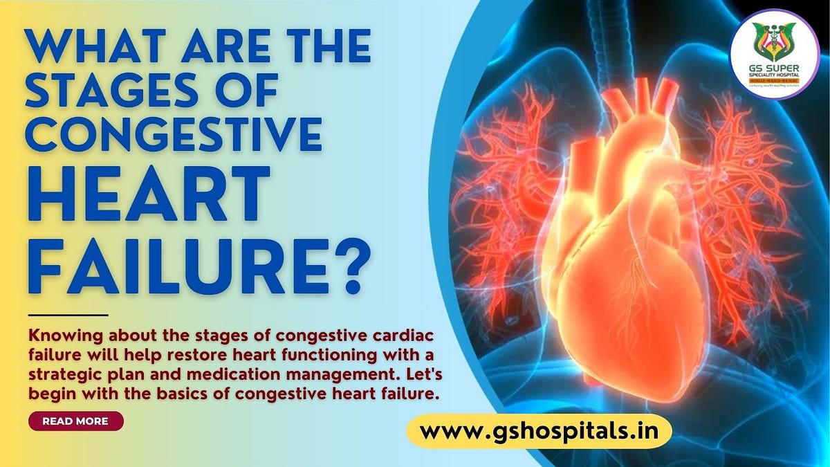 What are the stages of congestive heart failure? by GS Hospital Sep