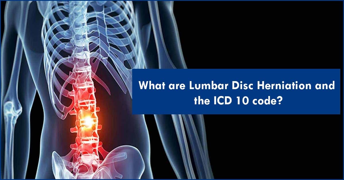 What are Lumbar Disc Herniation and the ICD 10 Code? Realignspine