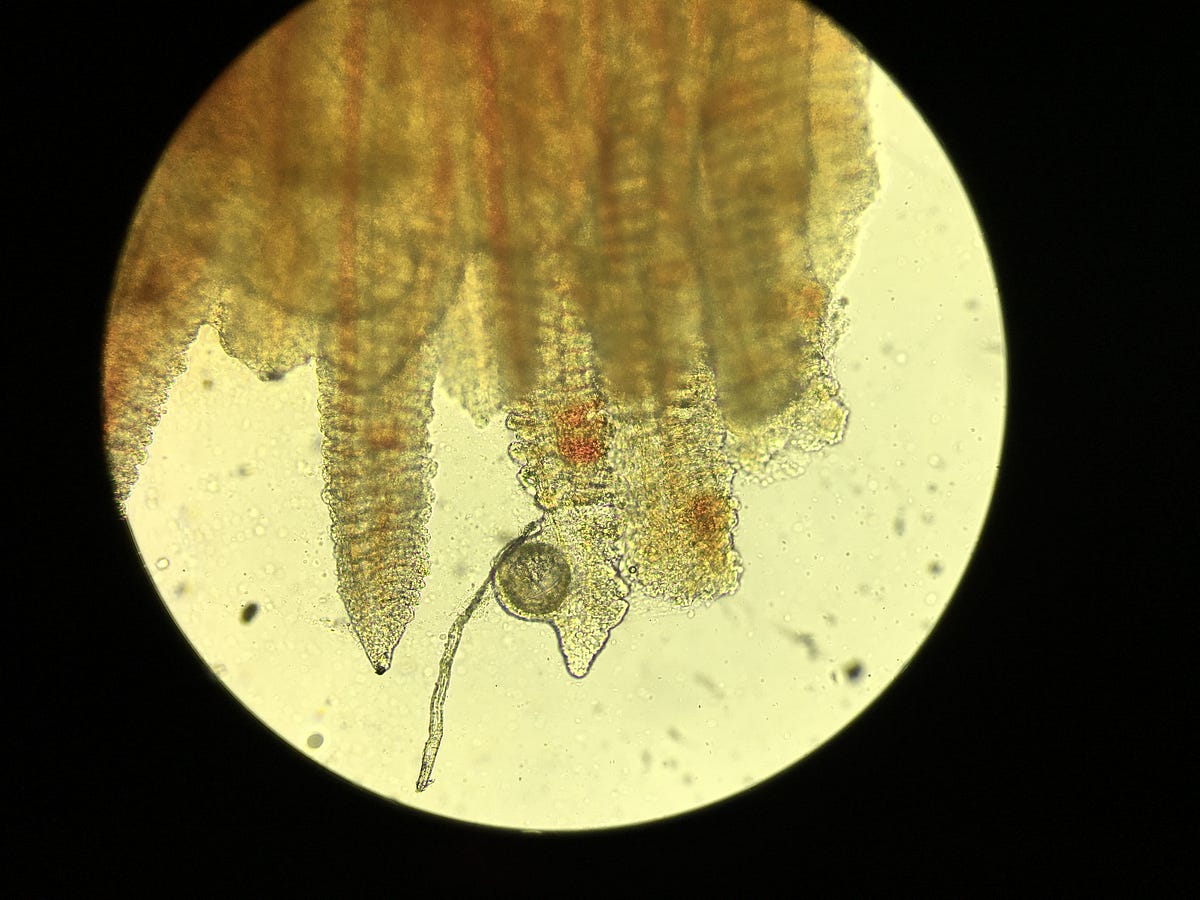 Juvenile steelhead lost to disease at Ringold Springs Hatchery by The