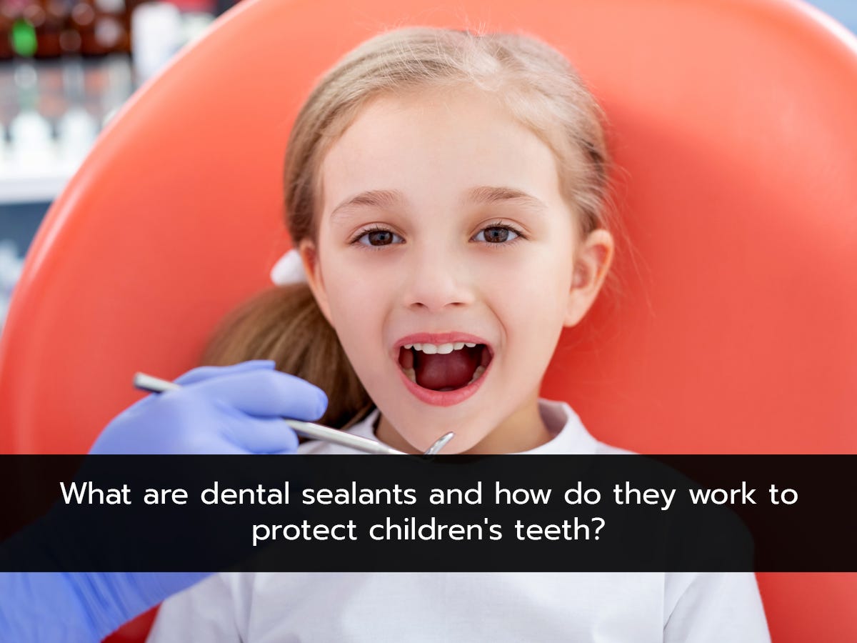 What are dental sealants and how do they work to protect children’s