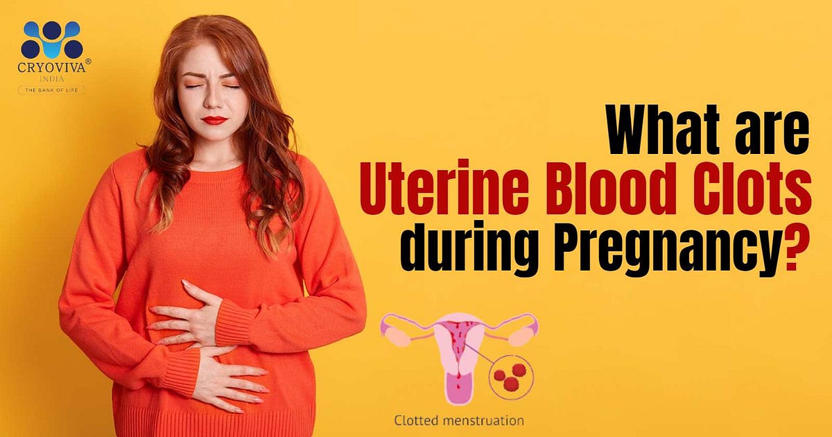 What are Uterine Blood Clots during Pregnancy? by Avani Singh May