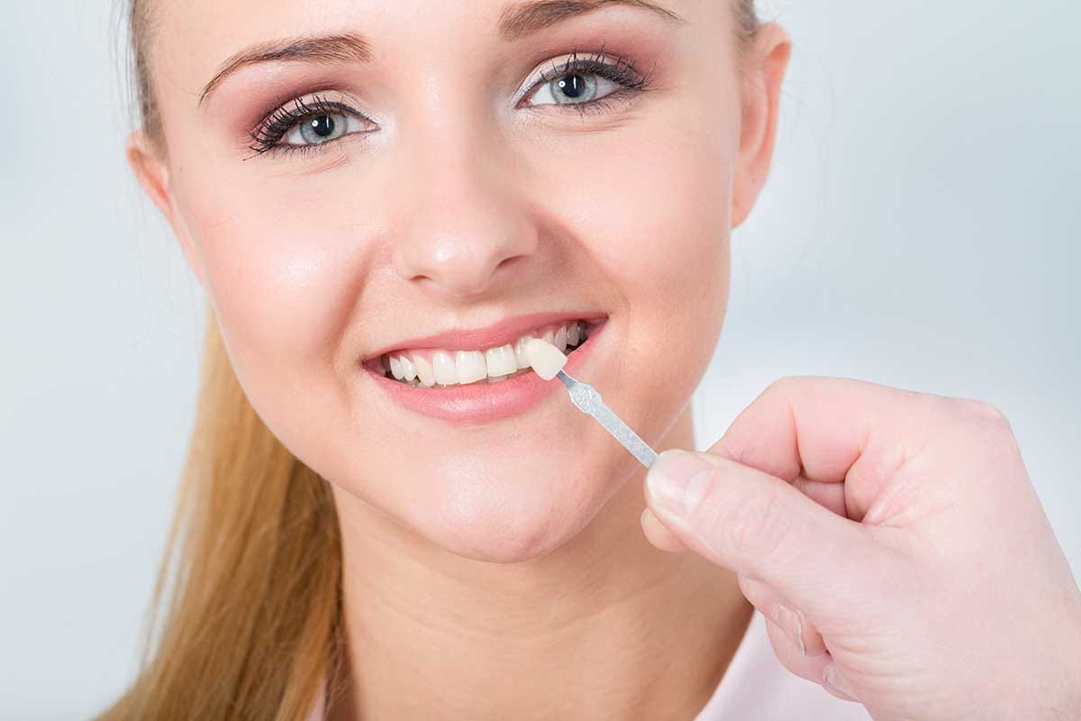 How to Tell If Your Veneers Require Replacement by Auden Park Family