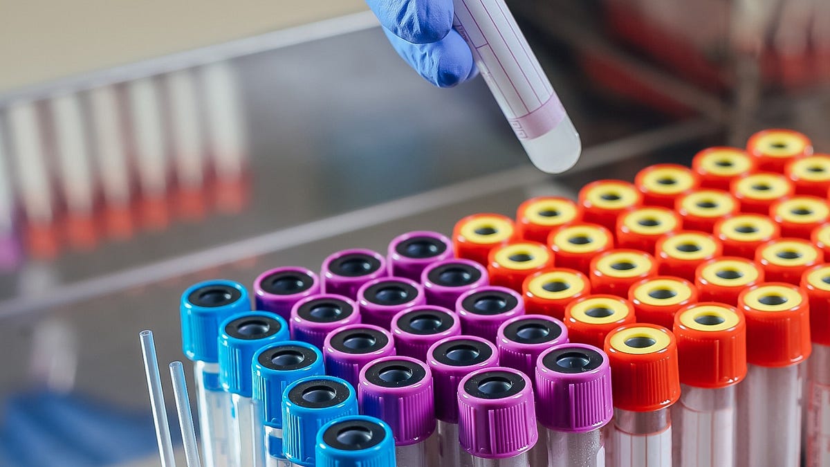 A Brief History of the Resin Shortage by Inzuri Health Medium